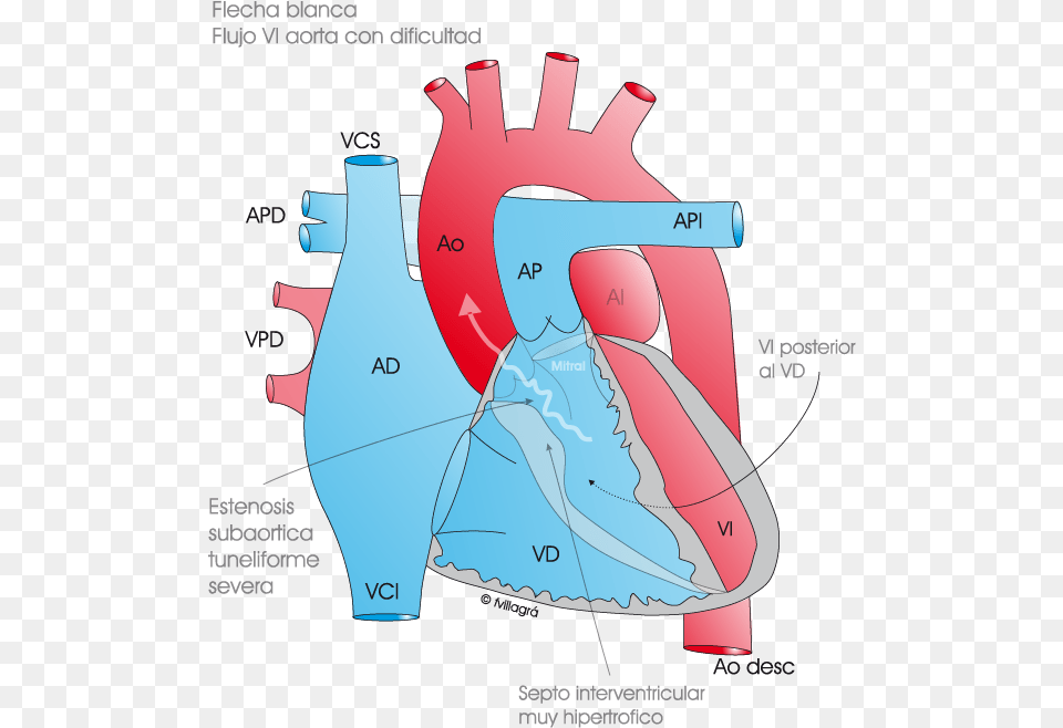 Cirugia De Konno, Chart, Plot, Dynamite, Weapon Png Image