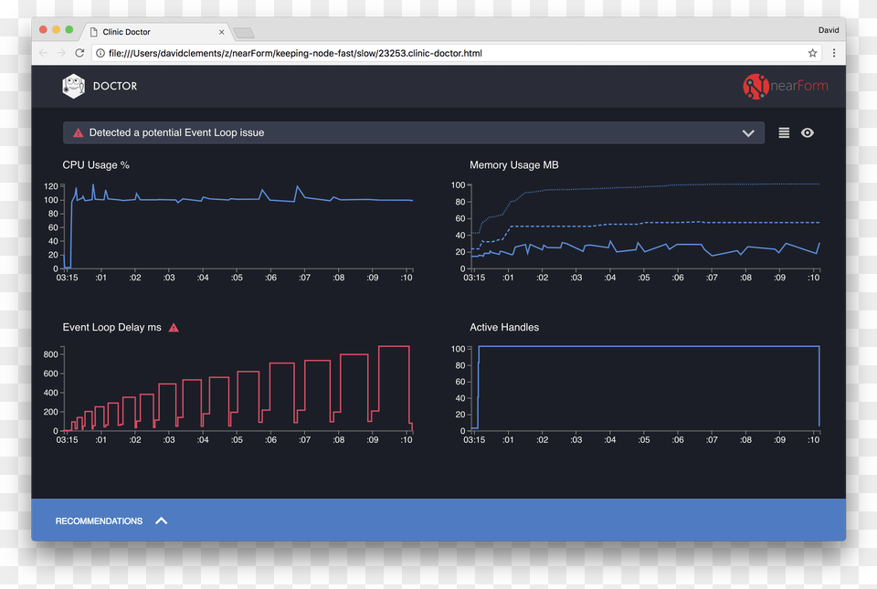 Clinic Doctor Has Detected An Event Loop Issue Node Js, Chart, Computer Hardware, Electronics, Hardware Free Transparent Png