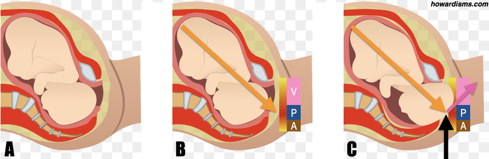 Clip Art, Body Part, Face, Head, Neck Free Transparent Png