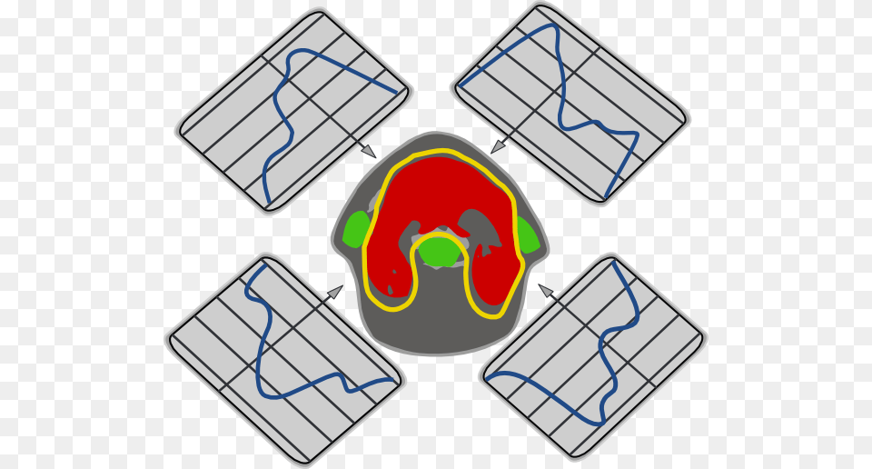 Clipart Info Imrt Png