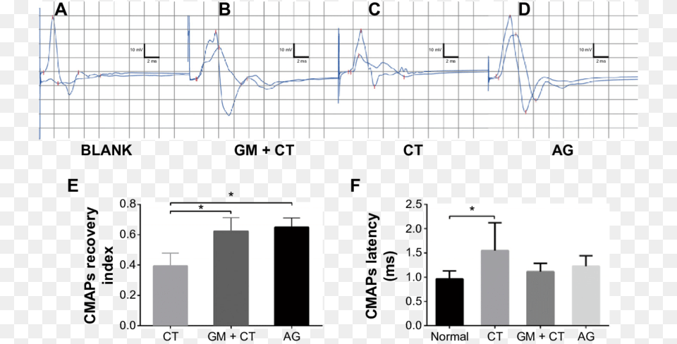 Cmap Detection Of Gastrocnemius Muscle At 20 Weeks39 Diagram, Chart, Plot Free Png