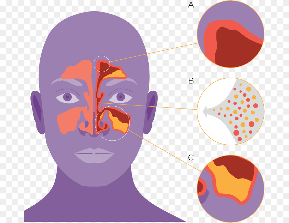 Cold Breath, Baby, Head, Person, Face Png