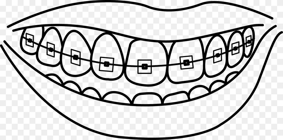 Collection Of With Teeth With Braces Coloring Pages, Body Part, Mouth, Person, Accessories Free Png Download