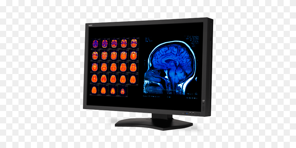 Color Megapixel Widescreen Medical Diagnostic, Computer Hardware, Ct Scan, Electronics, Hardware Png