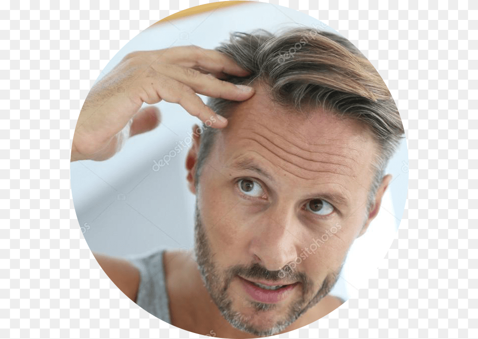 Come In And Discuss Whether You Might Be A Good Candidate Male Hair Loss, Adult, Face, Head, Man Png Image
