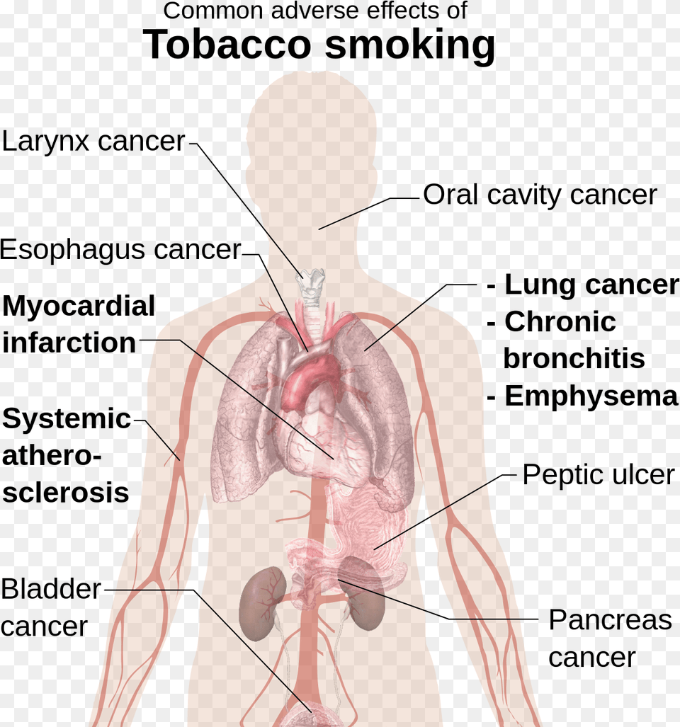 Common Adverse Effects Of Tobacco Smoking, Adult, Male, Man, Person Free Png