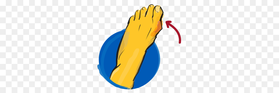 Common Foot And Ankle Issues Explained, Body Part, Person Png Image