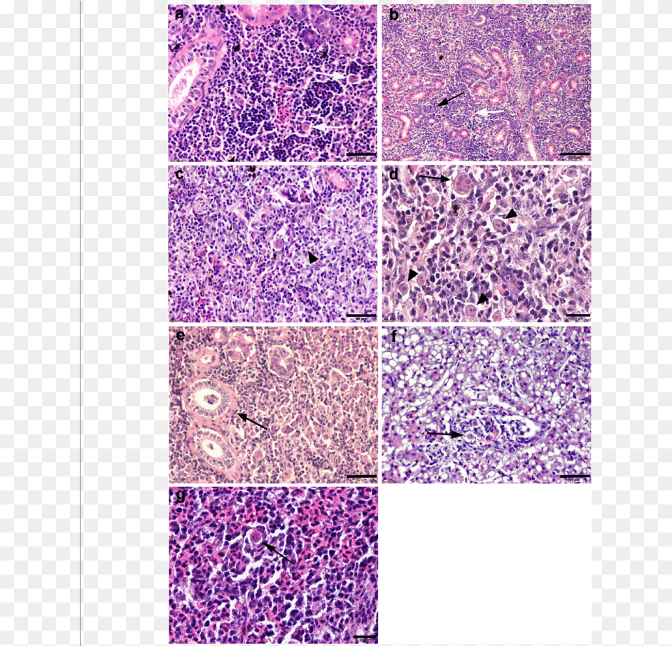 Comparative Histopathology Of Pkd On Rainbow Trout Pkd Mykiss Histopathology, Paper, Purple Free Png
