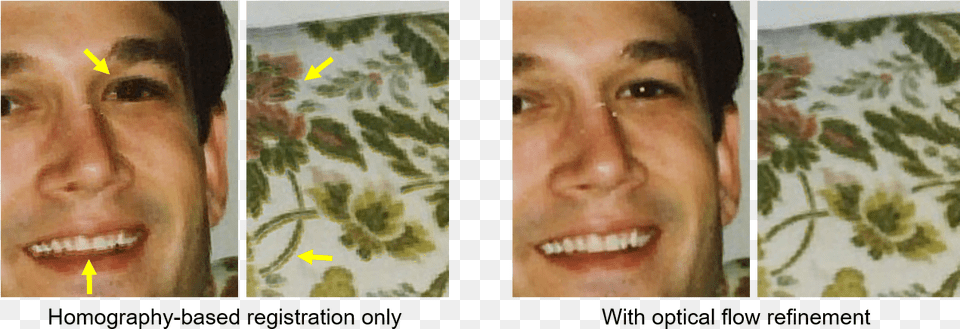 Comparison Between The Glare Removal Result With And Invertebrate, Person, Face, Head, Art Free Png