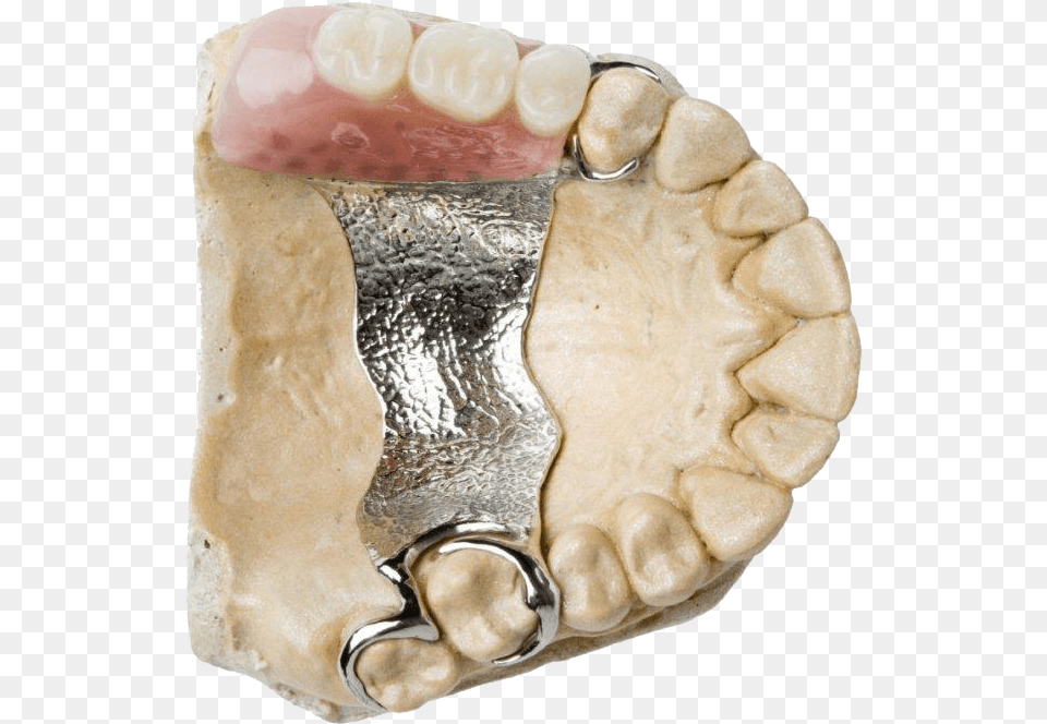 Complete Amp Partial Dentures Dentures Cobalt Chrome Denture Upper, Face, Head, Person, Body Part Free Png
