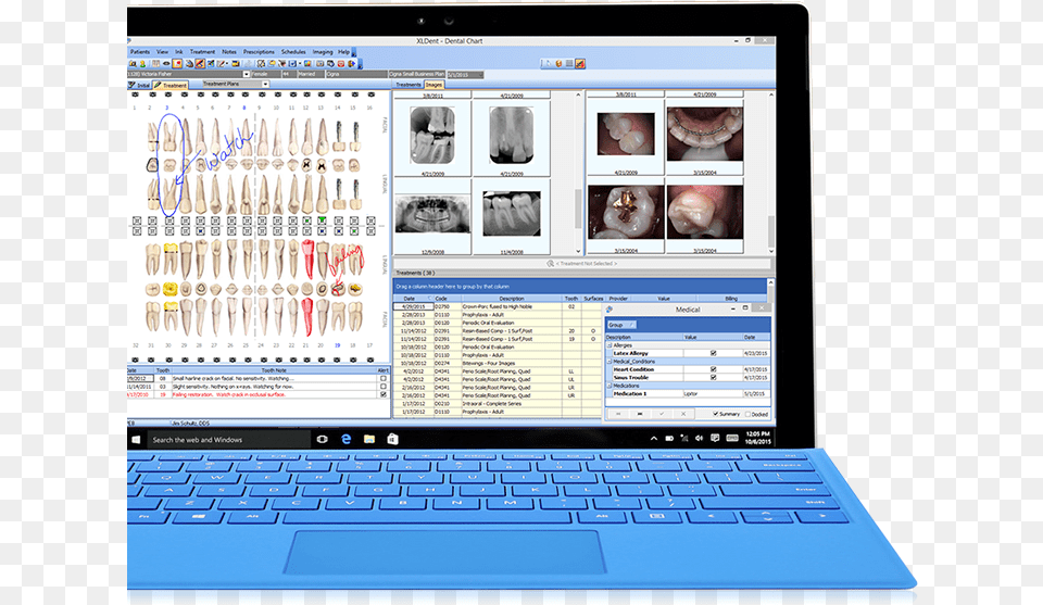 Comprehensive Suite Of Dental Software Xldent Dental Software, Computer, Pc, Laptop, Electronics Png