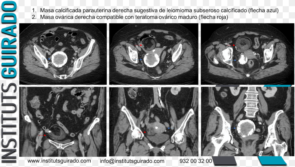 Computed Tomography, Ct Scan, Person, Adult, Male Png