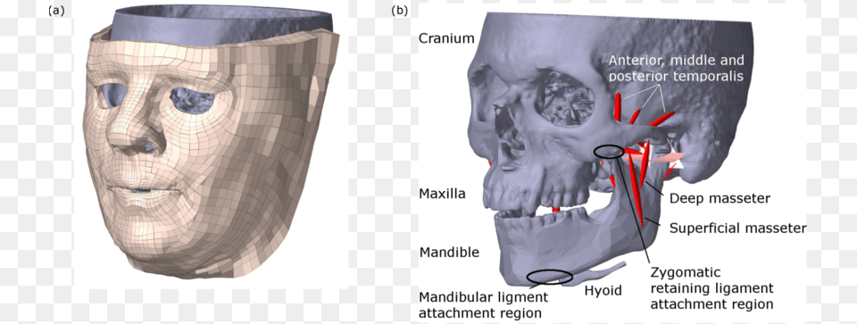 Computed Tomography, Head, Person, Diaper, Face Free Transparent Png