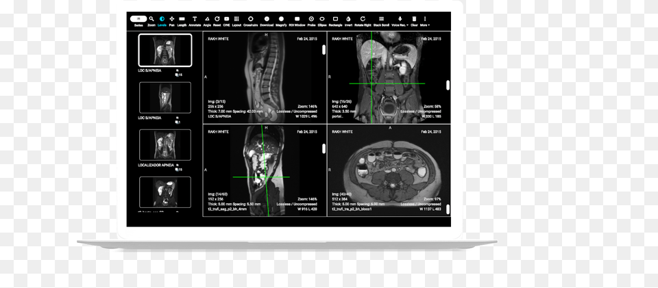 Computed Tomography, Ct Scan, Adult, Bride, Female Free Png