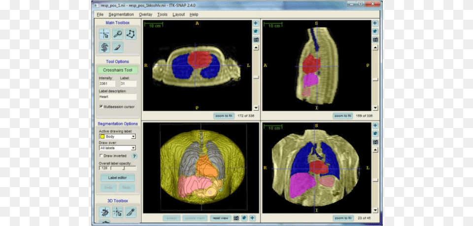 Computed Tomography, Ct Scan, Computer Hardware, Electronics, Hardware Free Png Download