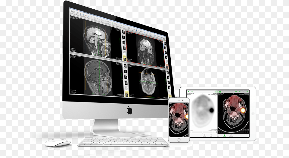 Computed Tomography, Ct Scan, Computer, Computer Hardware, Electronics Free Png Download