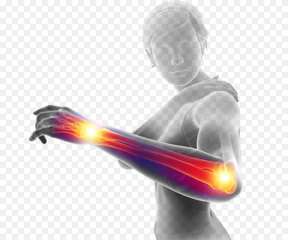 Computer Of Woman Looking At Inflamed Elbow Statue, Light, Adult, Female, Person Png Image