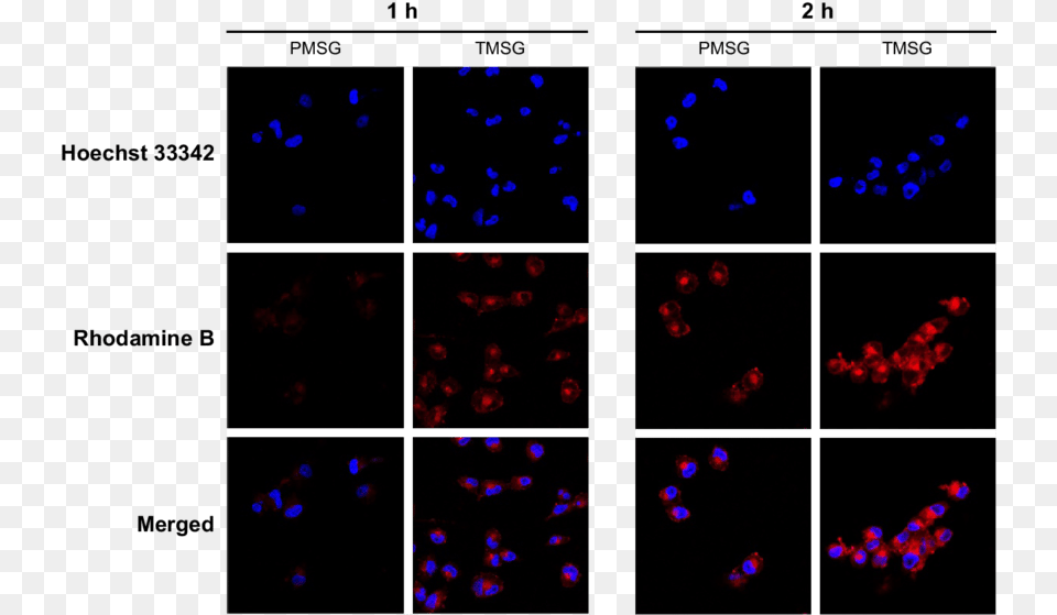 Confocal Laser Scanning Microscope Images Of Mda Mb Png Image