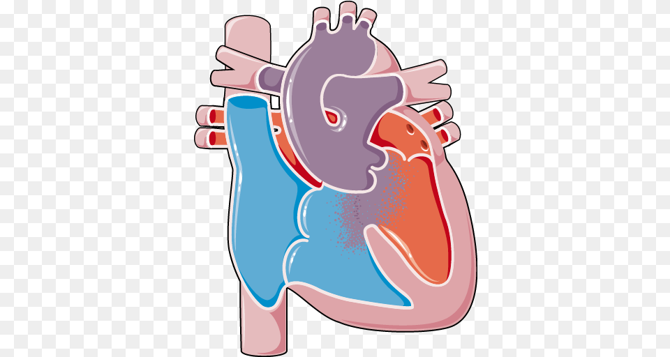 Congenital Heart Disease Trunctus Arteriosus Servier Congenital Heart Disease Transparent, Body Part, Stomach, Bottle, Shaker Png