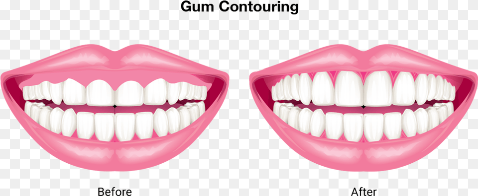 Contoured Teeth, Body Part, Mouth, Person Png Image