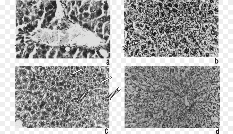 Control Animal Liver Showing Central Vein And Monochrome, Art, Collage Png Image