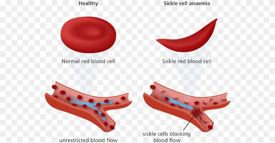 Cotton Clipart White Blood Cell Red Blood Cell Sickle Cell Free Png Download