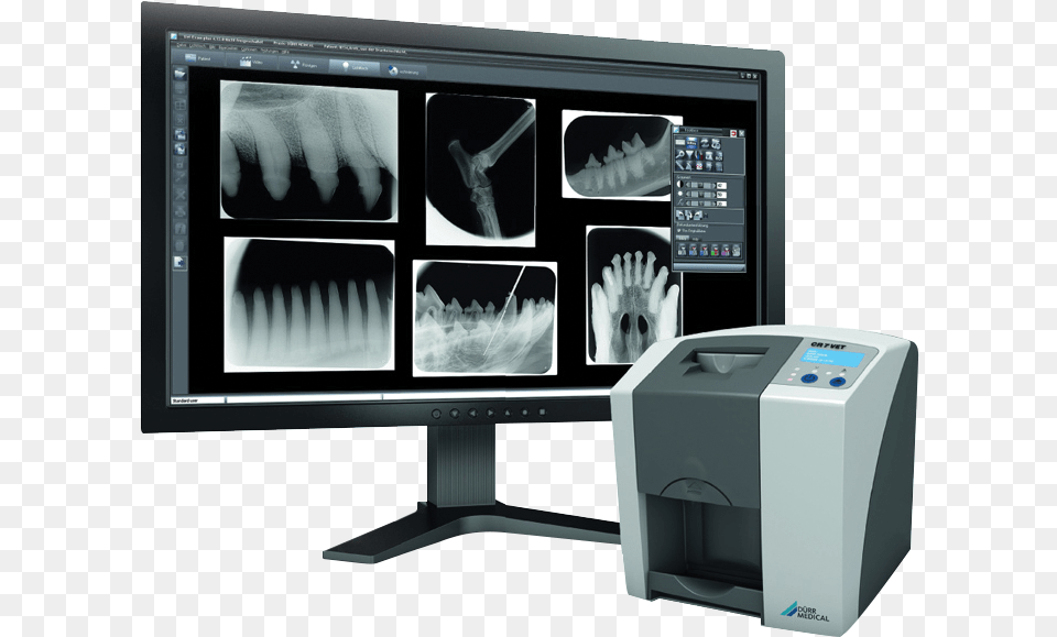 Cr7 Vet Dental Xray System Cr7 Dental X Ray, Computer Hardware, Electronics, Hardware, Monitor Free Png