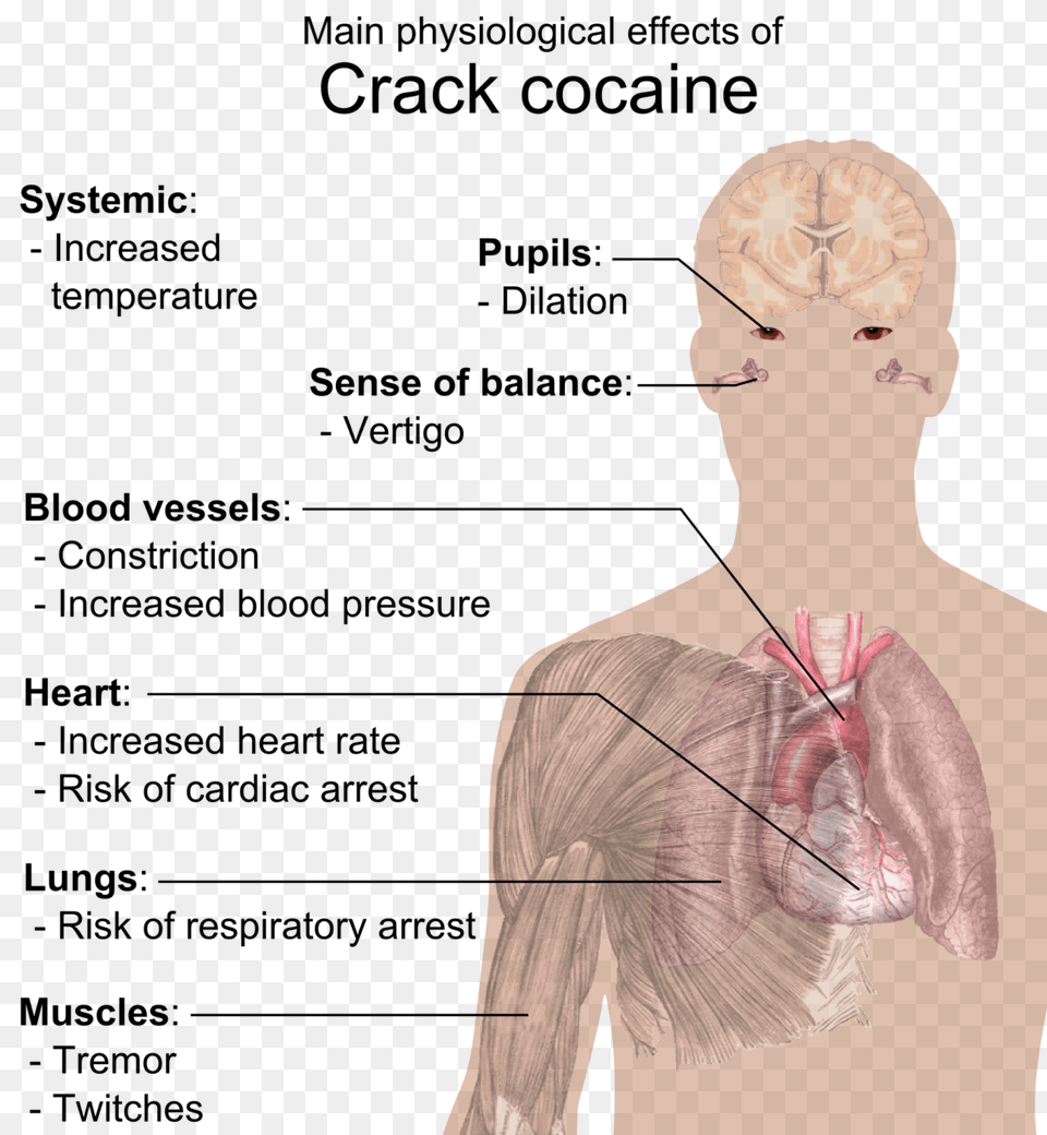 Crack Cocaine Does Crack Do To The Body, Adult, Female, Person, Woman Png Image