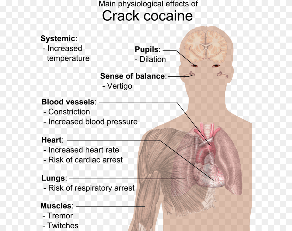 Crack Effects On Body, Body Part, Face, Head, Neck Png