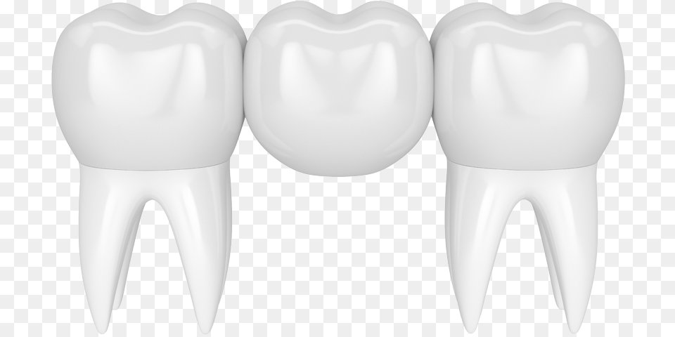 Crowns And Bridges Vampire, Body Part, Mouth, Person, Teeth Free Png Download