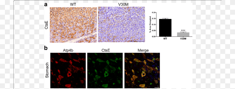 Ctse Protein Levels Are Reduced In The Stomach Of Transgenic Protein Png