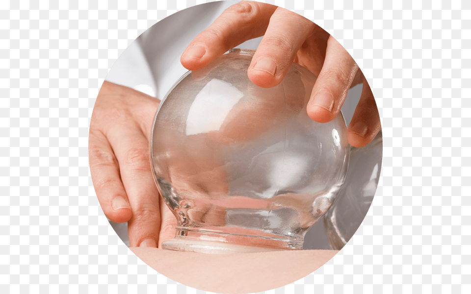 Cupping Cupping Therapy, Sphere, Person, Jar, Hand Free Transparent Png