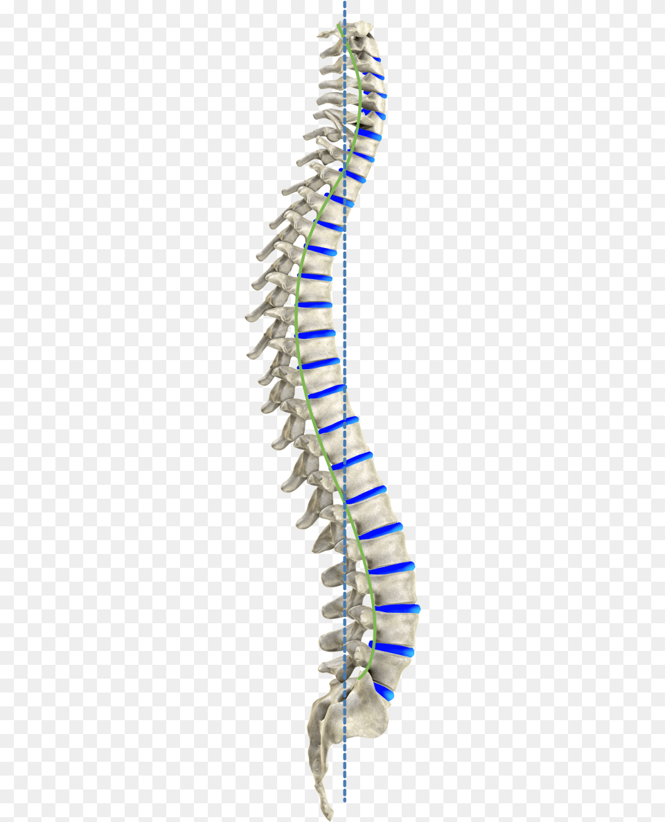 Curve Spine Spinal Cord, Ct Scan Png Image