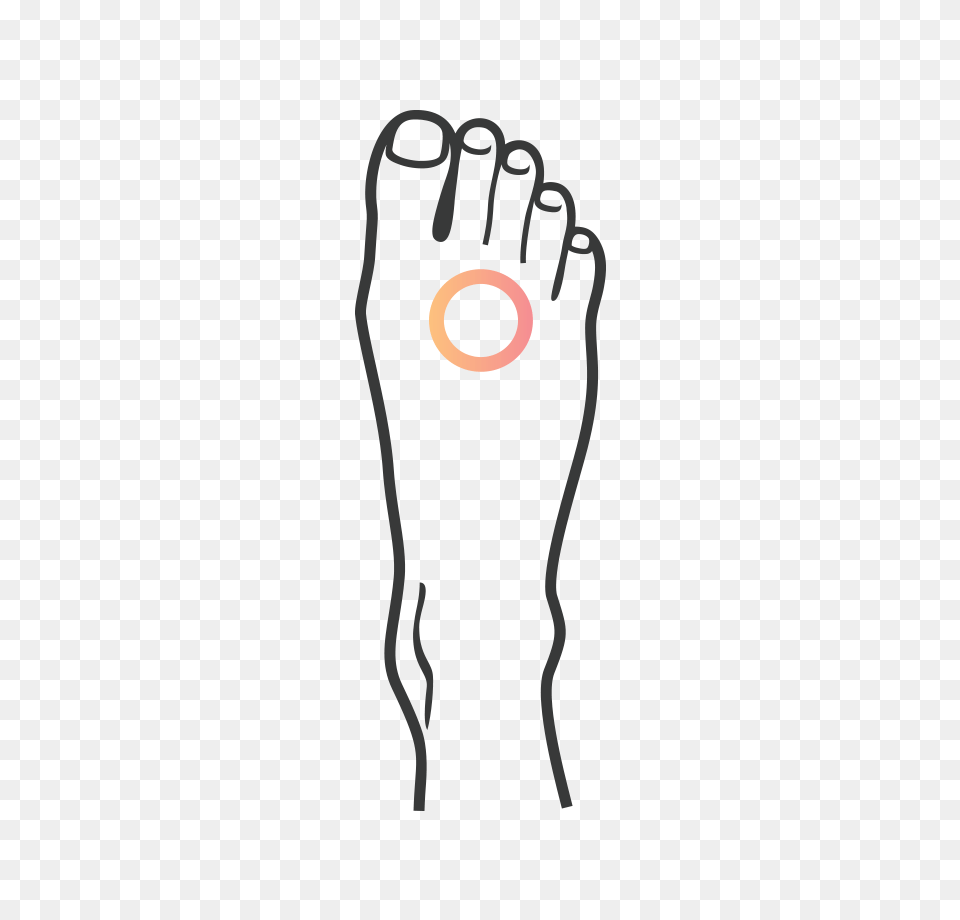 Custom Foot Orthotics Podiatrix, Body Part, Hand, Person, Animal Free Png