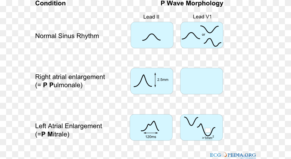 De P Wave Morphology, Text, Face, Head, Person Free Png