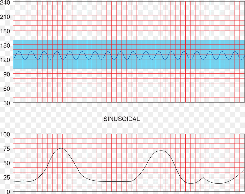 Deceleration In The Fetal Heart Rate Plot, Electronics, Oscilloscope Png Image