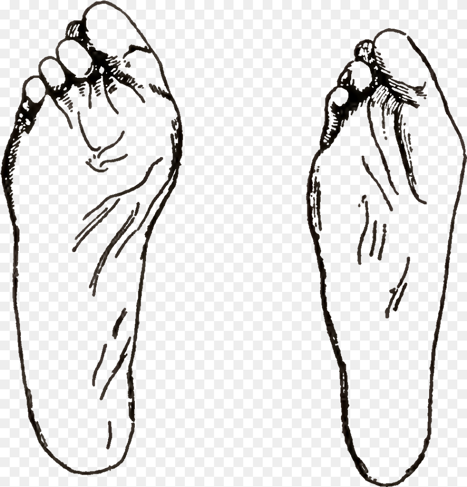 Deformities Of Feet Resulting From Bad Shoes, Body Part, Hand, Person, Clothing Free Transparent Png