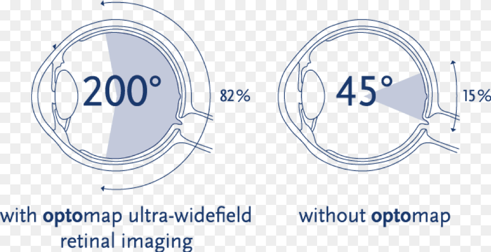 Degree Field Of View, Ct Scan, Lighting, Text Free Png