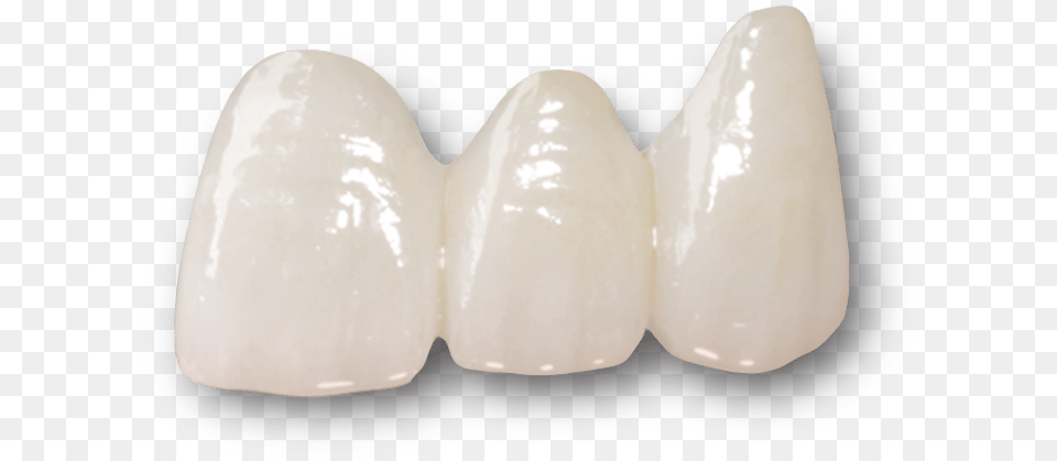 Dental Bridges Preston Layered Zirconia Crown, Body Part, Mouth, Person, Teeth Free Transparent Png