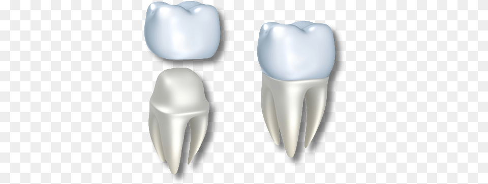 Dental Crowns In El Paso Tx Best Teeth Sol Coronas Dentales, Body Part, Cutlery, Electronics, Hardware Free Png