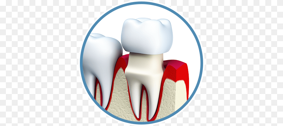 Dental Crowns Tooth Porcelain Figure, Body Part, Cream, Dessert, Food Free Png Download