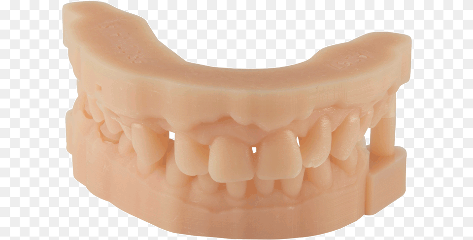 Dental D Material Prodways 3d Printed Dental Model, Body Part, Face, Head, Mouth Png Image