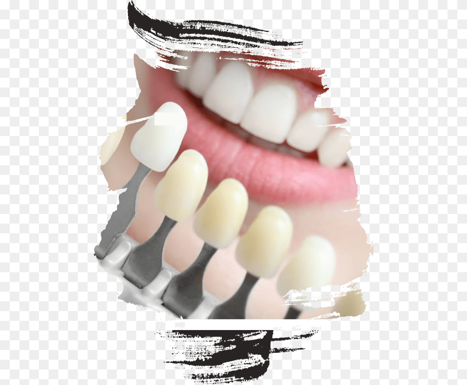 Dental Hospital Near Me Lentes De Contato Dental Uberaba, Body Part, Teeth, Person, Mouth Png Image