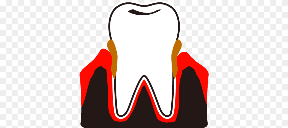 Dental Plaque Calculus Periodontal Clip Art, Accessories, Goggles, Dynamite, Weapon Free Png