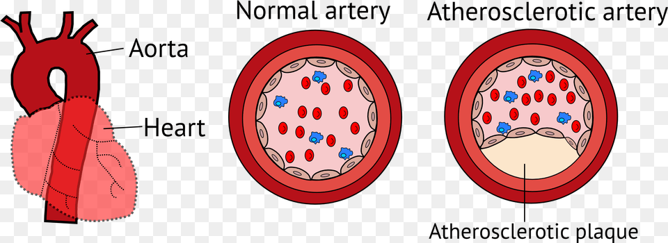 Dental Plaque Itinerary Blood Vessels Unraveling The Circle Png Image