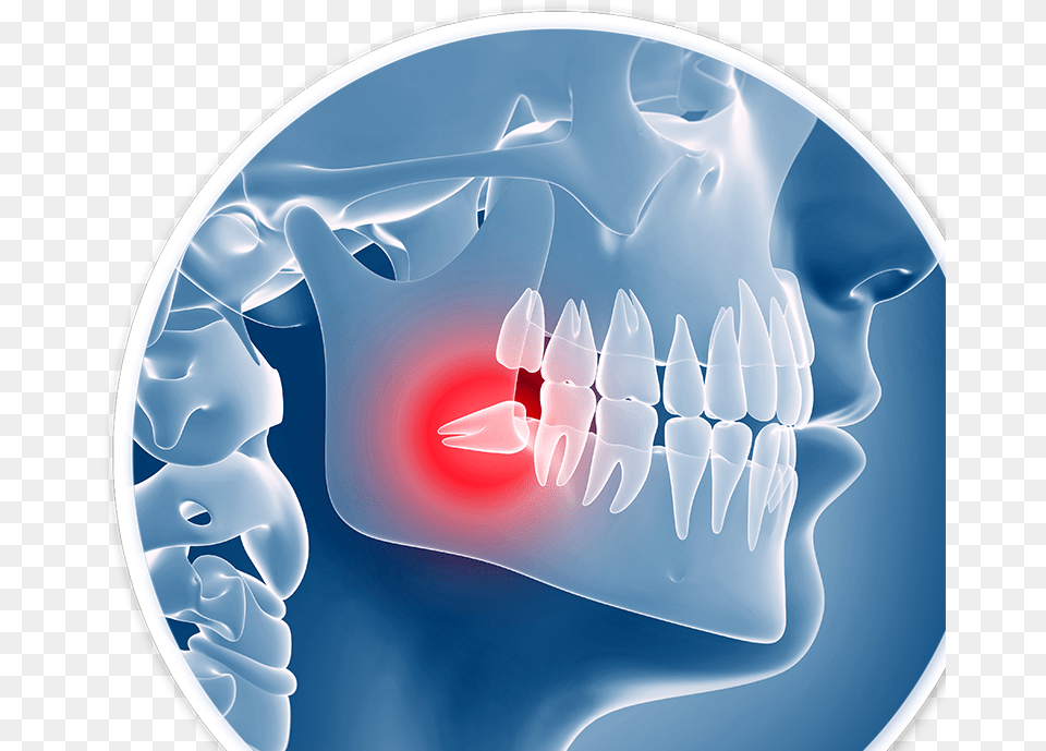 Dental Problems, Ct Scan Png Image