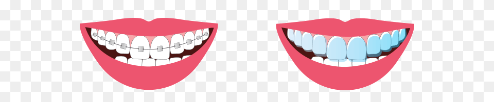 Dentell Orthodontics, Body Part, Mouth, Person, Teeth Free Png
