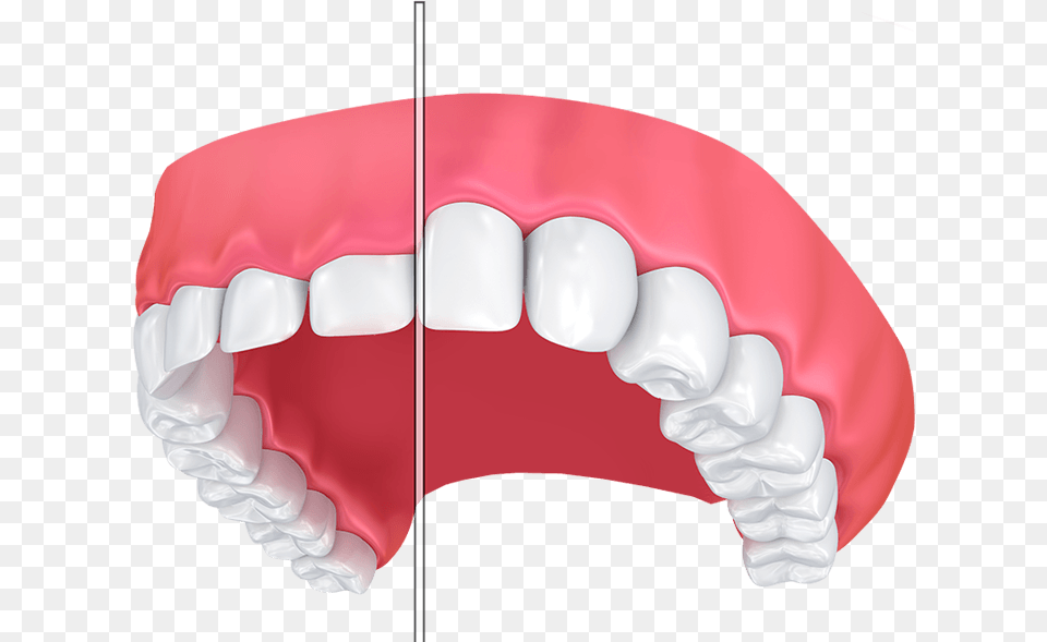 Dentistry, Body Part, Mouth, Person, Teeth Png