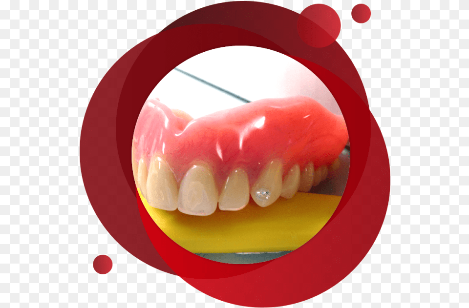 Denture Teeth Jewellery Dentistry, Body Part, Mouth, Person, Face Free Png