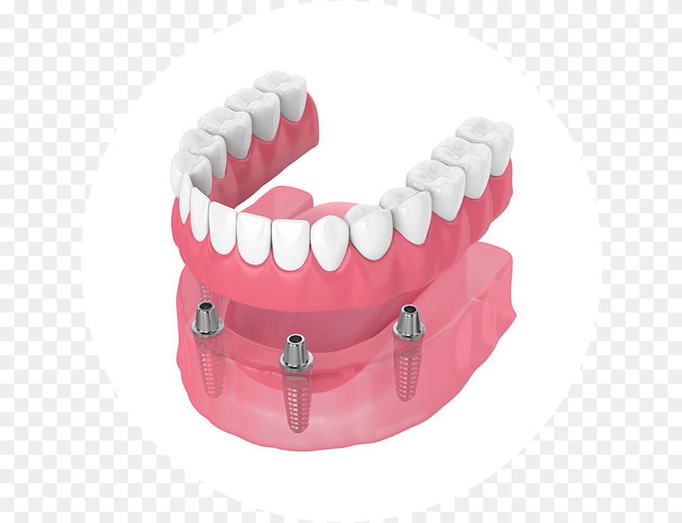 Dentures, Teeth, Body Part, Person, Mouth Png